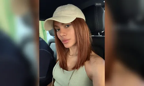 Anitta exibe o rosto após procedimentos estéticos e aparece com affair