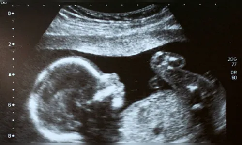 Adolescente grávida força aborto, asfixia bebê e joga cadáver no lixo