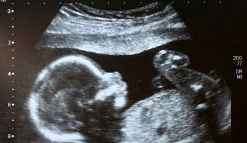 Adolescente grávida força aborto, asfixia bebê e joga cadáver no lixo