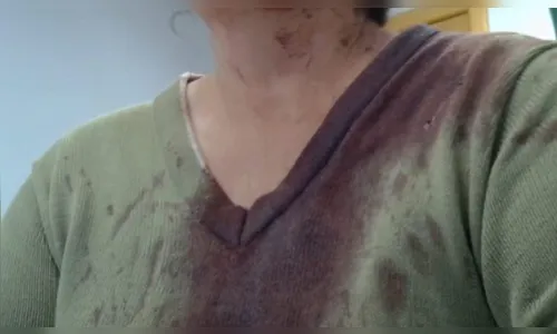 Mulher é presa após atacar irmã com cabo de aço no Paraná