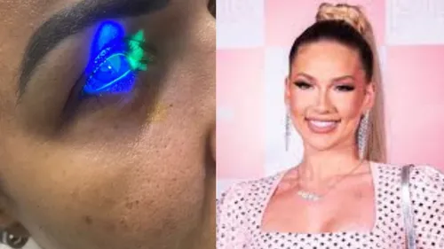 Mulher afirma que produto da Wepink queimou suas córneas