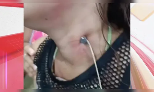 Namorado fura pescoço da companheira com prego e depois foge