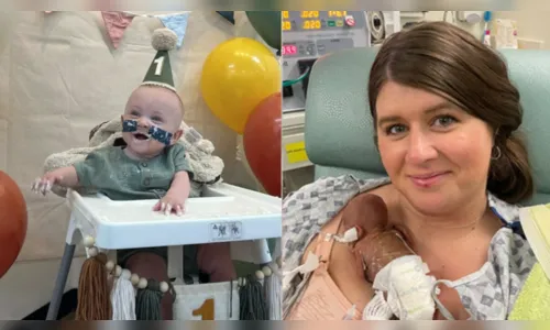 Bebê mais prematuro do mundo a sobreviver completou 1 ano