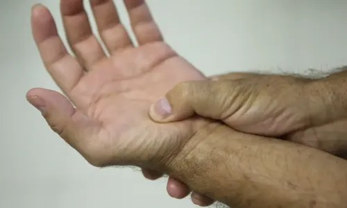 O SUS oferece tratamento para quem possui a síndrome