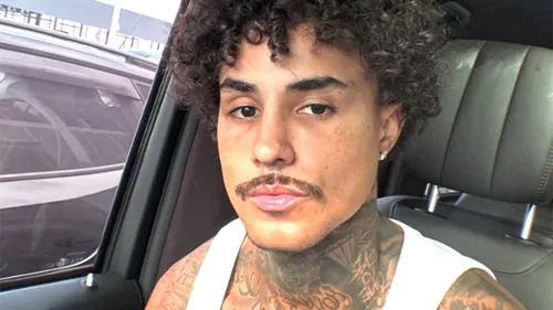 O artista não tem previsão de alta hospitalar