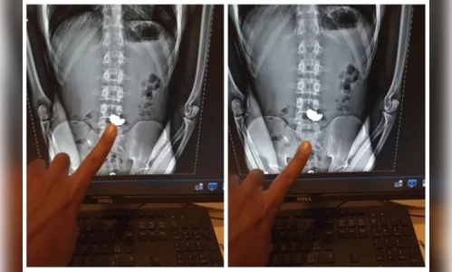 Homem engole corrente de ouro roubada ao ser parado por policiais