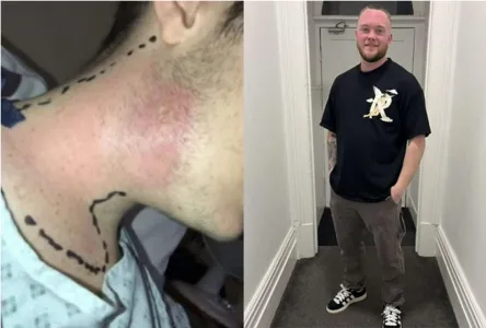 O jovem ficou com uma cicatriz no pescoço após as cirurgias.