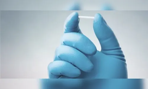 SUS passa a ofertar implante contraceptivo hormonal gratuito