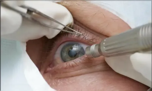 Falta de consultas regulares aumenta chance de doenças graves na visão