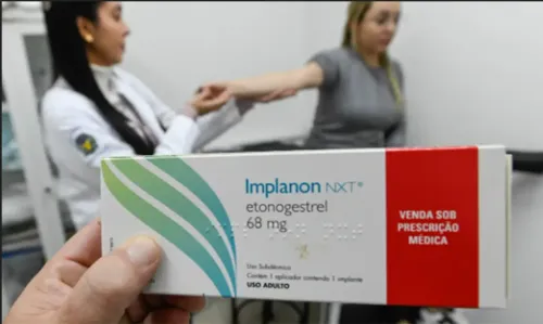 O Ministério da Saúde já anunciou que vai disponibilizar o Implanon no SUS.