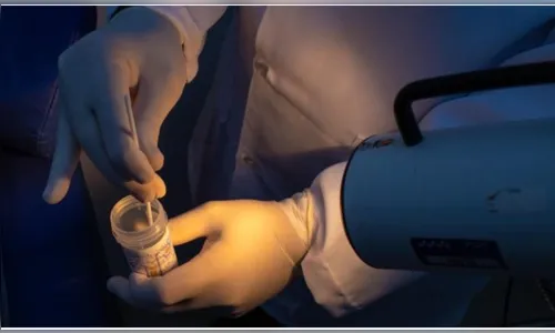 Paraná vai oferecer exame tecnológico para detectar precocemente HPV