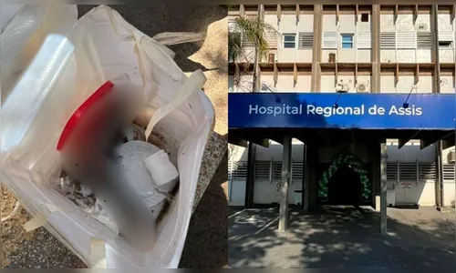 Pé humano é encontrado por trabalhadores em cooperativa de reciclagem