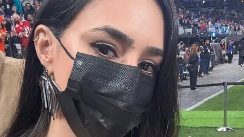 Depois mostrou como sua boca ficou inchada