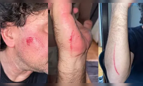 Passageiro ataca motorista de app com facão durante corrida no PR