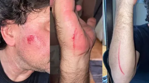 Motorista teve ferimentos superficiais após ataque