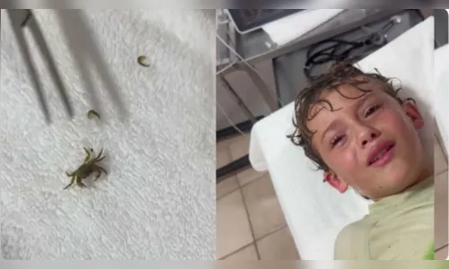 Menino tem caranguejo vivo retirado do ouvido e vídeo viraliza