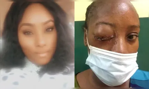 Grávida perde bebê e a visão após complicação rara de resfriado