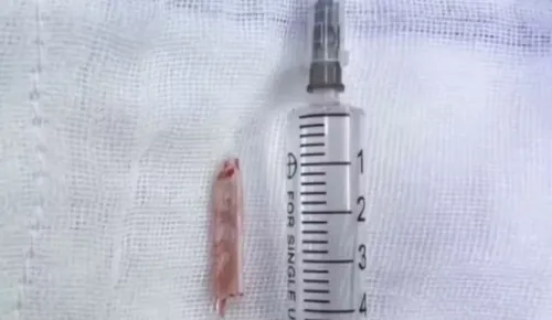 O vidro tinha cerca de 2 cm