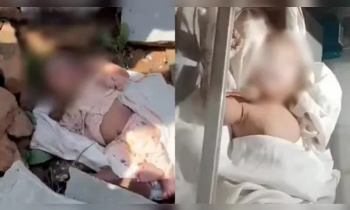 Recém-nascido é deixado em mata com pedra na boca e lábios colados