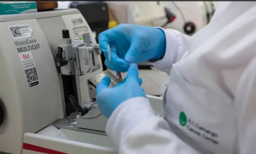 Cura de câncer de próstata pode chegar a até 98%