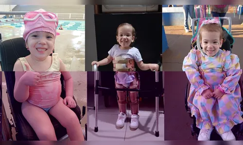 Apucarana: família pede ajuda para cirurgia de menina com doença rara