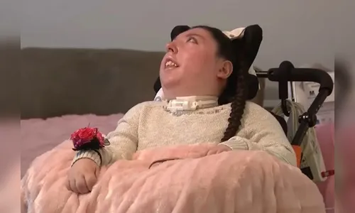 Jovem que nasceu sem cérebro completa 20 anos nos EUA