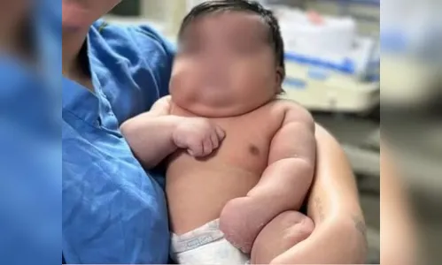 Mãe leva 50 pontos após parto normal de bebê de 6,5 quilos