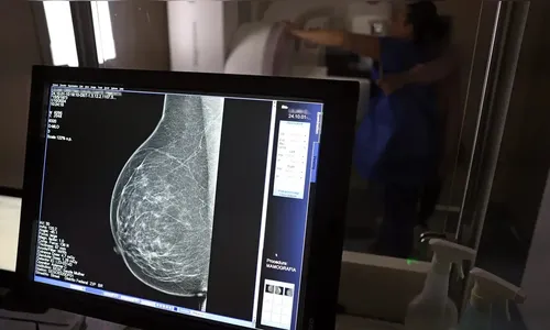 Região soma 43 óbitos por câncer de mama e colo do útero neste ano
