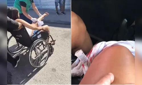 Grávida é baleada durante tiroteio e passa por parto de urgência