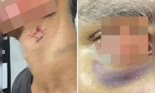 Jovem é achado desnutrido após mais de um ano em cárcere em Goiânia