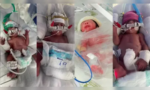 Quadrigêmeos nascem no Paraná após fertilização in vitro