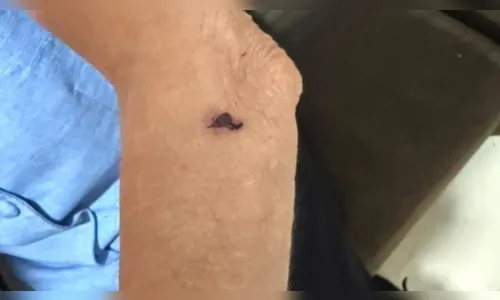 Mulher é presa por agredir e manter mãe idosa em cárcere privado no PR