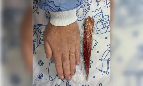 Farpa de 23 cm atravessa perna de criança em ensaio no Teatro Guaíra