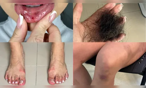 Dentista sobrevive à tortura e abuso; suspeito é preso no Paraná