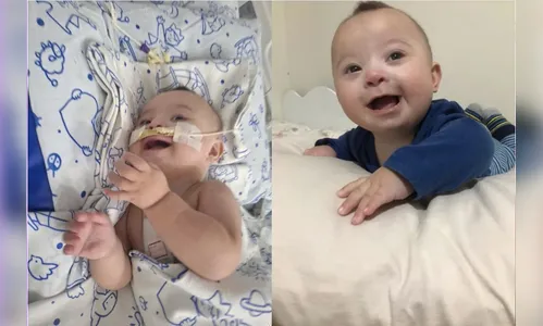 Ação solidária ajuda pais de bebê com Síndrome de Down internado