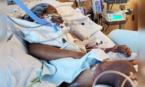 Menino de 7 anos perde as duas pernas após complicações da gripe