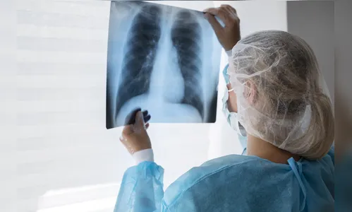 Apesar de recuo nos casos, mais de 2,6 mil morreram de pneumonia na região em 2025