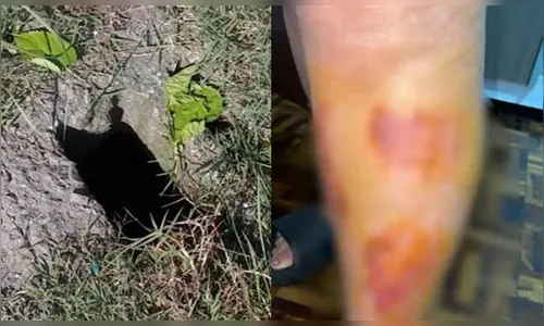 Moradora cai em bueiro sem tampa e fica ferida no PR