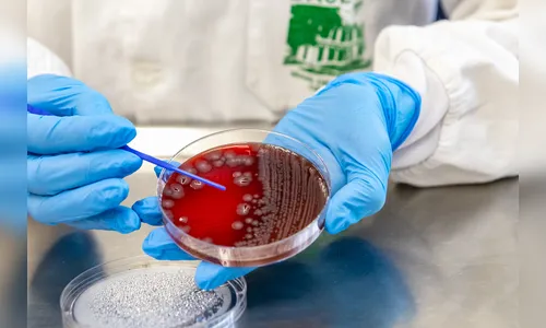 Com o calor, Saúde do Paraná alerta para cuidados contra viroses