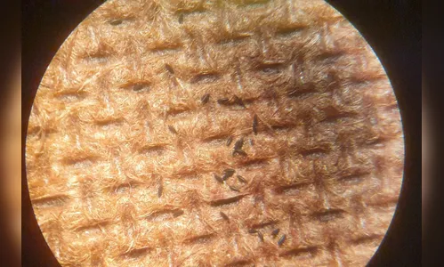 Arapongas tem 1.411 casos confirmados de dengue e sete de chikungunya