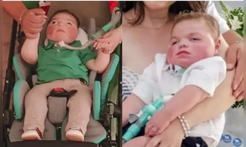 Criança morre aos 5 anos após lutar contra doença rara no PR