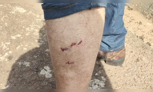 Tutor é multado em R$ 3,4 mil após cachorro atacar homem em Arapongas