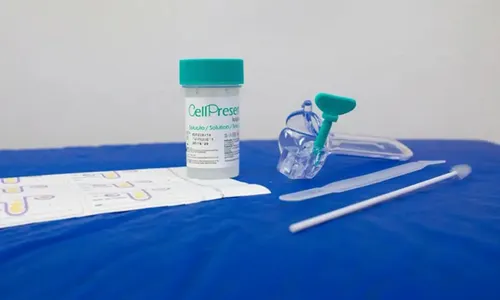 Guia orienta sobre mudança no rastreamento do câncer de colo do útero