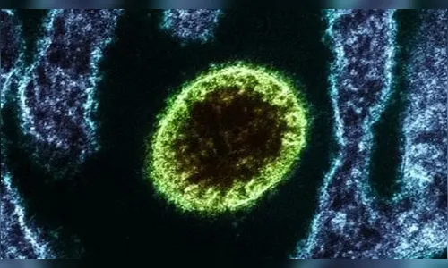 Como age o vírus Nipah, que gera alerta na Índia e quais os riscos de chegar ao Brasil