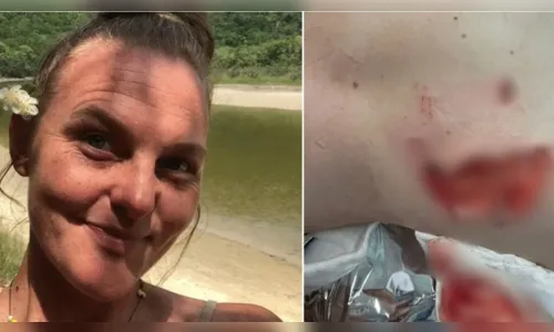 Mulher é atacada nas nádegas por capivara em lagoa de Florianópolis