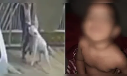 Vídeo mostra pitbull atacando criança de 2 anos na frente da casa da avó; veja