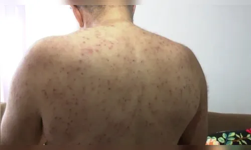 Aposentado sobrevive após mil picadas de abelha no PR: 