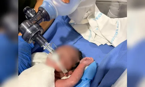 Recém-nascido em parada cardíaca é salvo após resgate com helicóptero