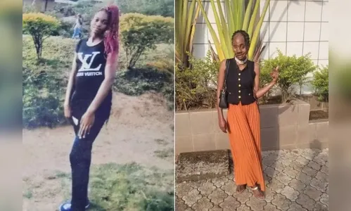 Jovem se recupera após ter rosto partido por 5 tiros; veja fotos