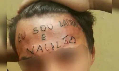 Jovem tatuado na testa com 